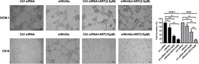 Corrigendum: Artesunate Suppresses Choroidal Melanoma Vasculogenic Mimicry Formation and Angiogenesis via the Wnt/CaMKII Signaling Axis